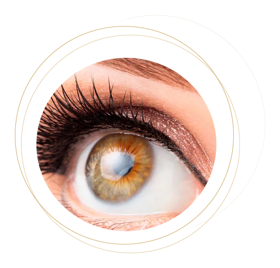 Blefaroplastia Blefaroplastia