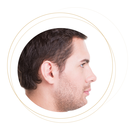 Rinoplastia Masculina